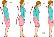Как научиться ходить с прямой спиной
