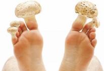 Что такое грибок на ногтях ног и как от него избавиться
